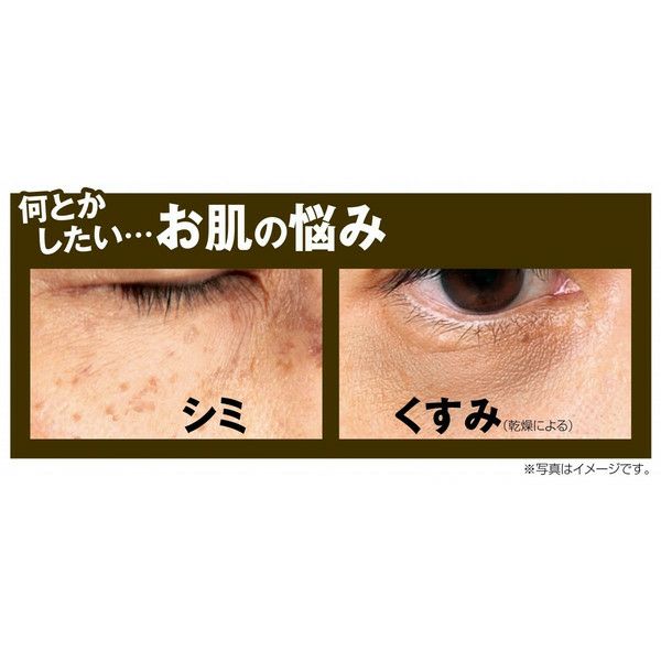 ホワイトロワイヤル 極濃美白 プレミアムエッセンス 20g | 美人生活